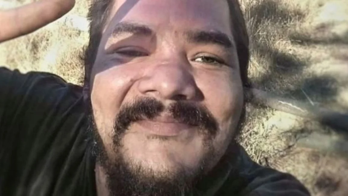 Víctima de trauma ocular muere en la conmemoración del 18-O
